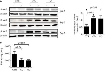 Reciprocal Regulation Between Smad7 and Sirt1 in the Gut